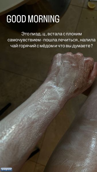 Алена Савкина обварилась кипятком