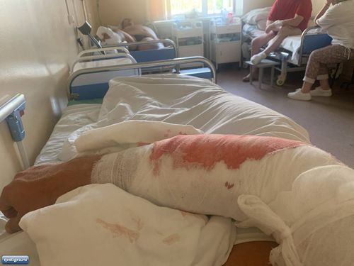Антону Санникову сделали операцию