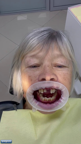 Мама Маши Кохно наконец вставила зубы