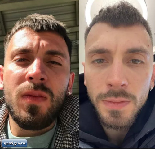 Михаил Козлов похудел и осунулся после ухода из Дома 2