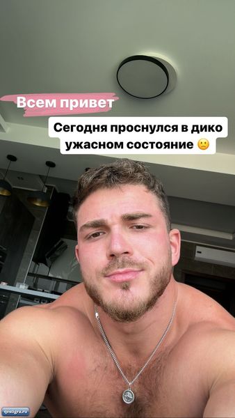 У Караулы проблема с ногой