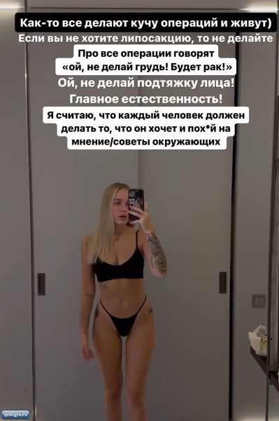 Милена Безбородова возмущена, что ее отговаривают от липосакции