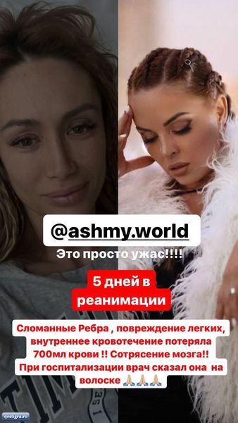 Алена Ашмарина попала в реанимацию Алена Ашмарина попала в реанимацию
