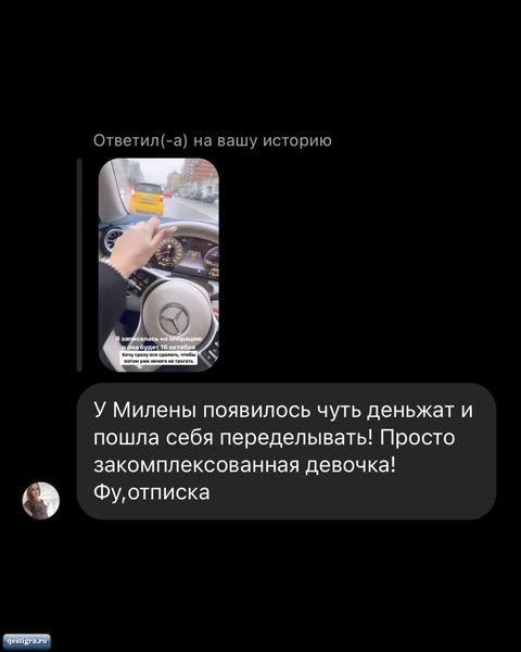 Милена Безбородова собралась делать липосакцию подбородка