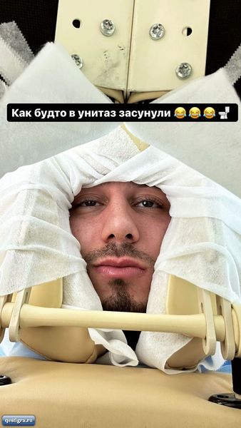 Арай Чобанян лег на повторную операцию по пересадке волос