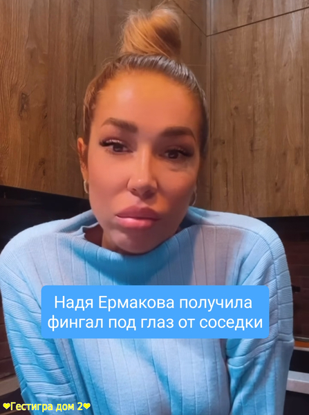 Надя Ермакова получила фингал под глаз от соседки