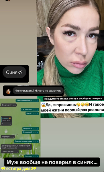 Надя Ермакова получила фингал под глаз от соседки