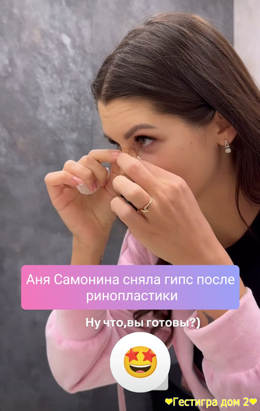 Аня Самонина сняла гипс после ринопластики