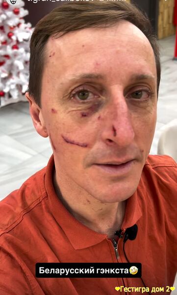 Вероника избила мужа