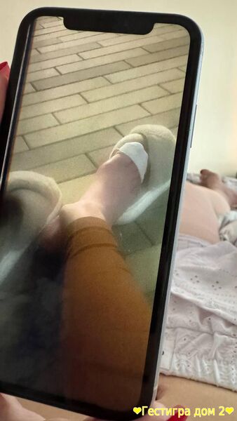 Звезда «ДОМа-2» Саша Черно разнесла всех в больнице после перелома ног