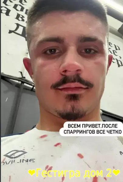 Никита Гуранда пострадал на подготовке к соревнованиям